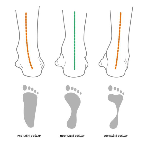 zobrazení pozice kotníku při pronaci, supinaci a neutrálním došlapu